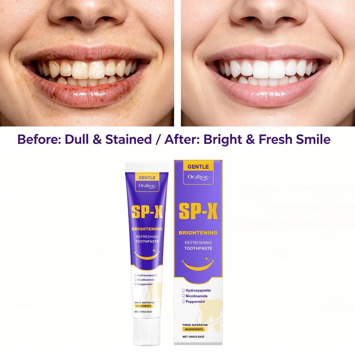 Brightening Toothpaste Teeth Whitening Stain Remover for Daily Oral Care at Home