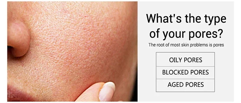 Salicylic Acid Pore Shrinking Cream Skin Repair Acne Treatment for Face and Smooth Texture