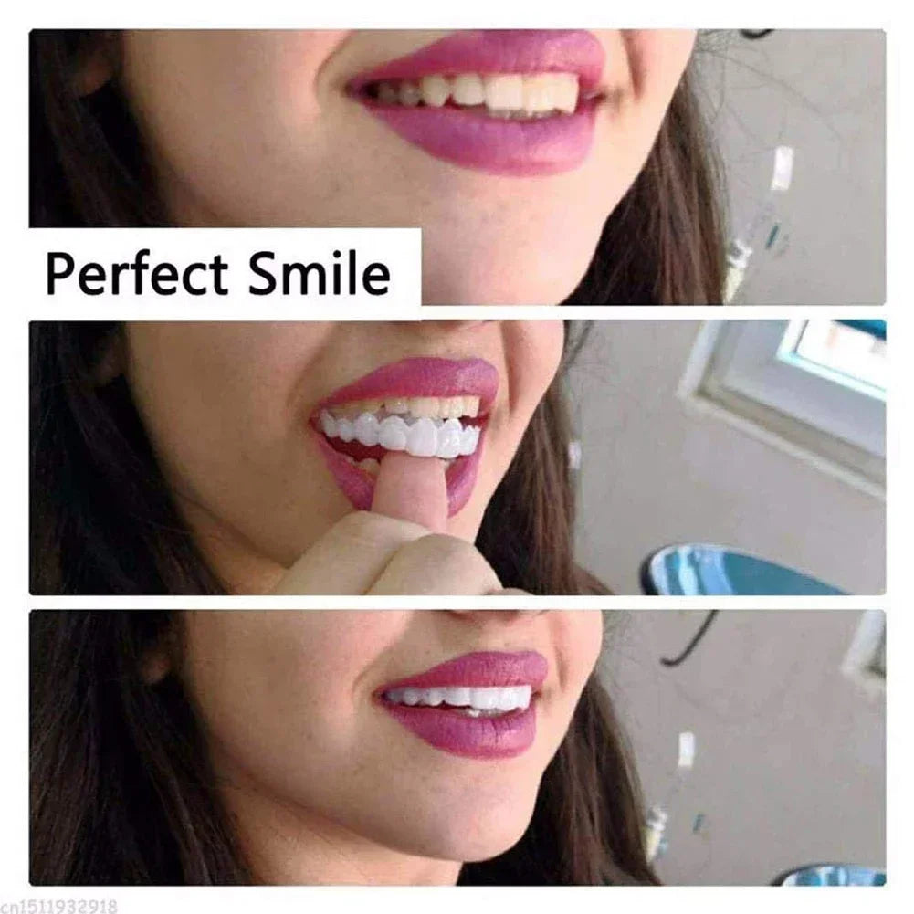 Veneer Snap on Teeth Kit Temporary Whitening Replacement for Men and Women Smile Enhancement