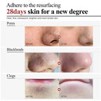 Salicylic Acid Pore Shrinking Cream Skin Repair Acne Treatment for Face and Smooth Texture