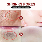 Salicylic Acid Pore Shrinking Cream Skin Repair Acne Treatment for Face and Smooth Texture