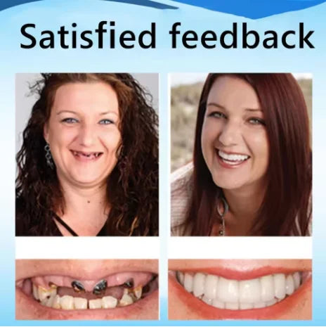 Custom Fit Dentures Boil to Shape Comfortable Dental Arch for Daily Use at Home