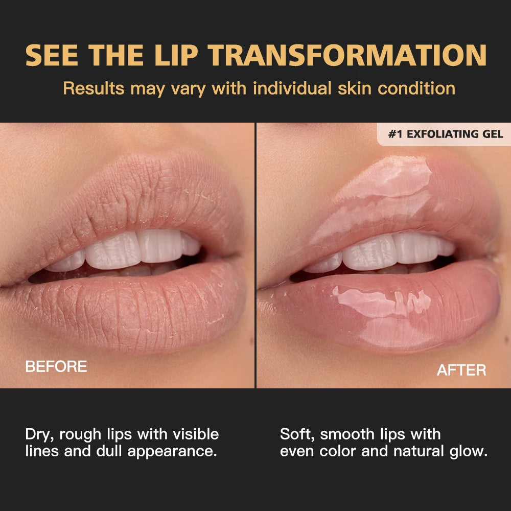 Hydrate Lips Set Exfoliating Gel and Peptide Moisturizer for Daily Lip Care Routine