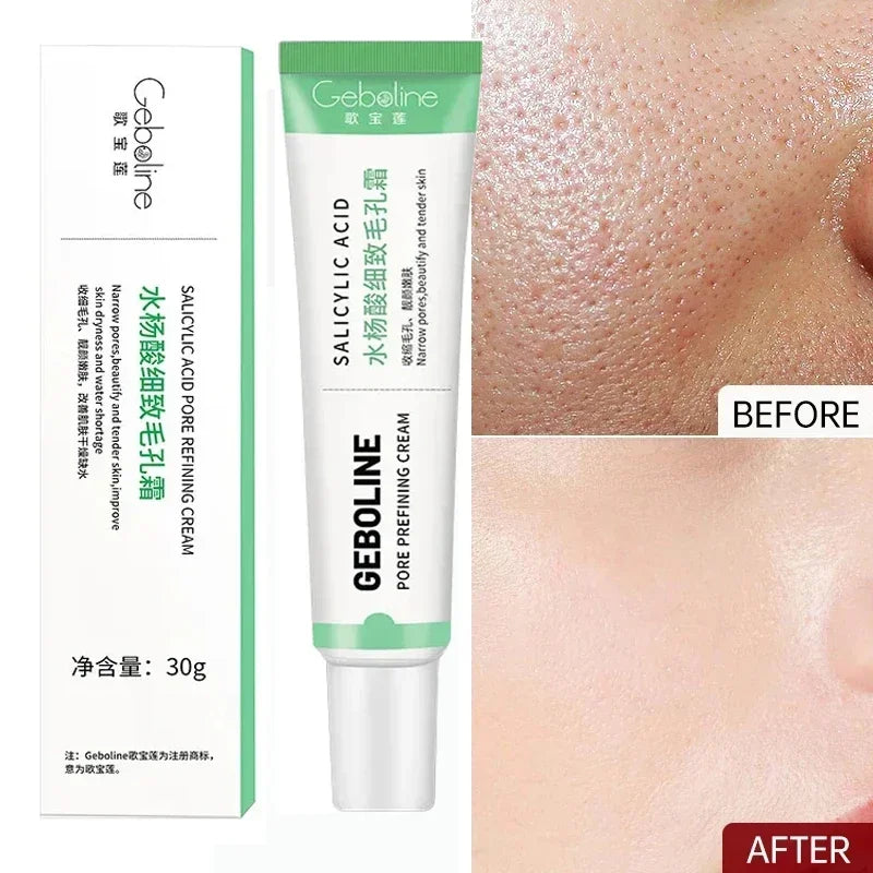 Salicylic Acid Pore Shrinking Cream Skin Repair Acne Treatment for Face and Smooth Texture