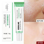 Salicylic Acid Pore Shrinking Cream Skin Repair Acne Treatment for Face and Smooth Texture