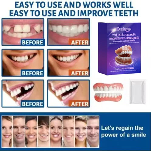 Silicone Snap On Dentures Realistic Teeth Replacement for Natural Smile During Social Events