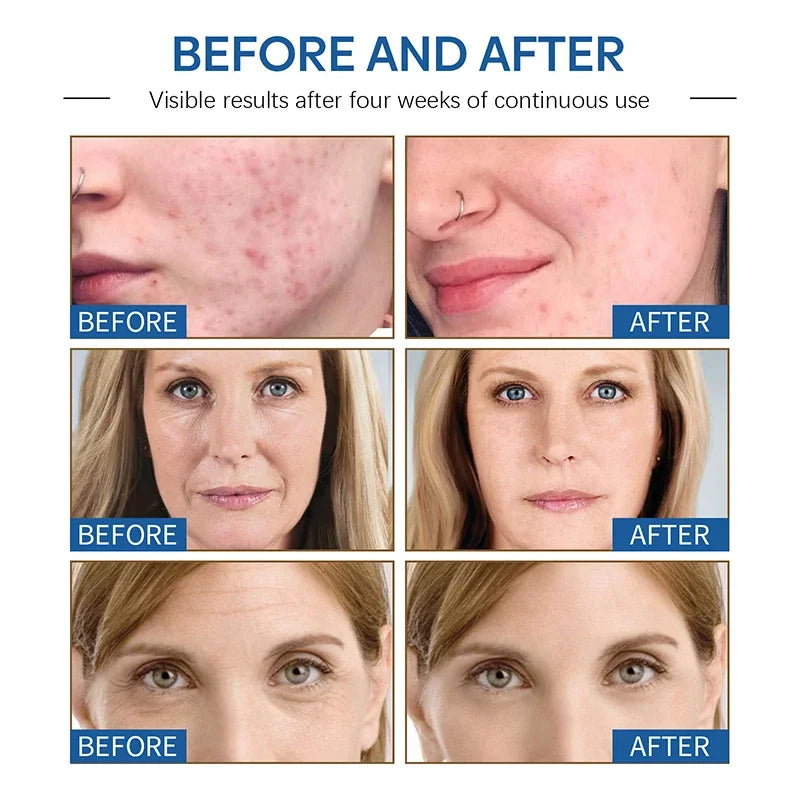 Magic Face Cream Anti Aging Moisturizer for Smoothing Fine Lines and Firming Skin Daily Routine - 3