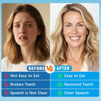 Full Mouth Silicone Dentures Natural Lifelike Teeth for Daily Comfort and Oral Care