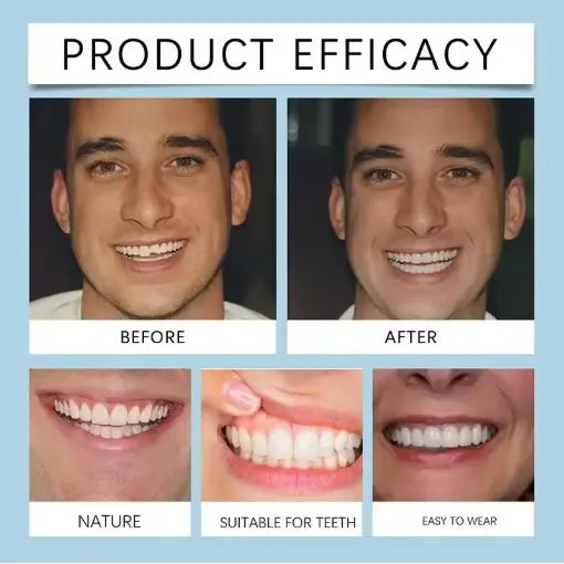 Flexible Silicone Dentures Realistic False Teeth Comfort Fit for Natural Smile Replacement