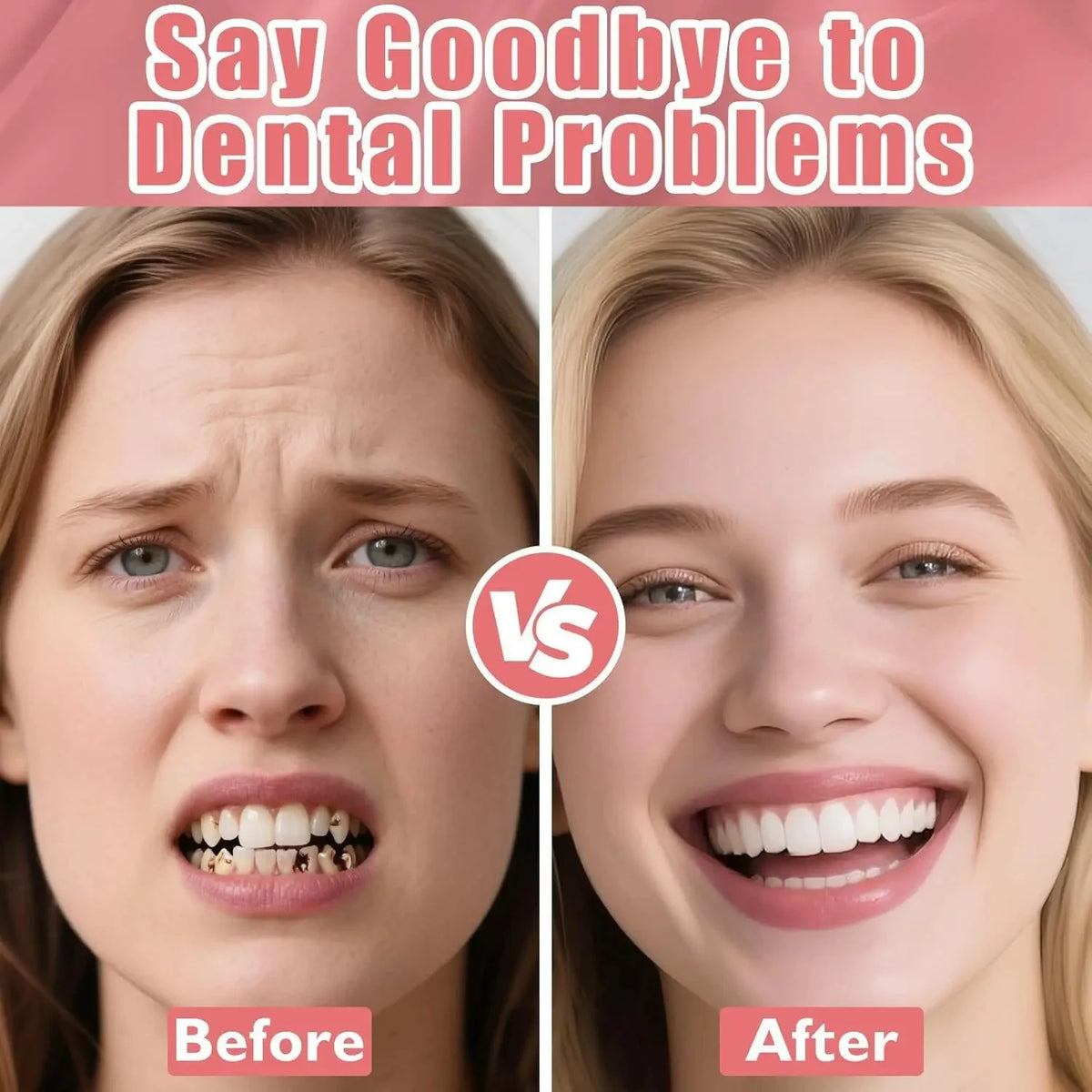 Realistic Full Denture Set Comfortable False Teeth for Men and Women for Natural Confident Smiles