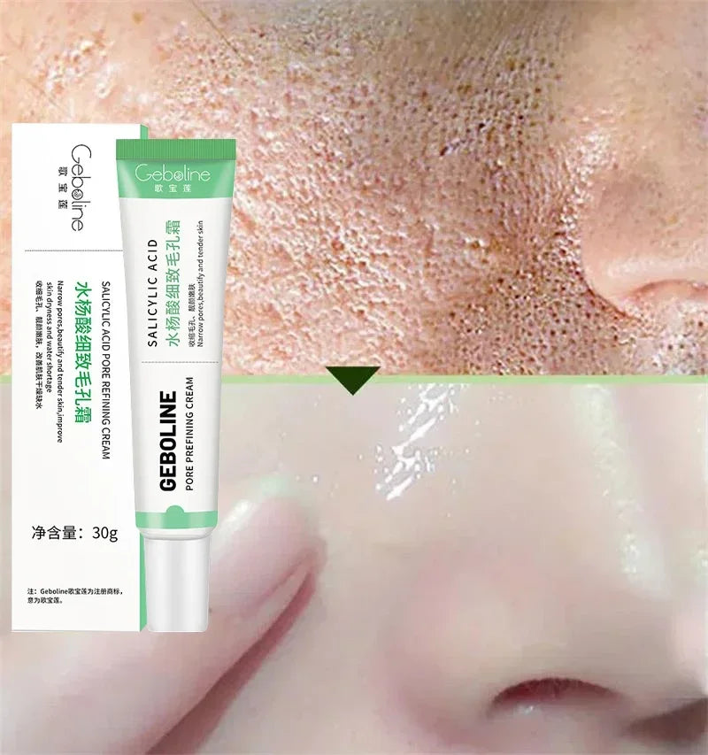 Salicylic Acid Pore Shrinking Cream Skin Repair Acne Treatment for Face and Smooth Texture