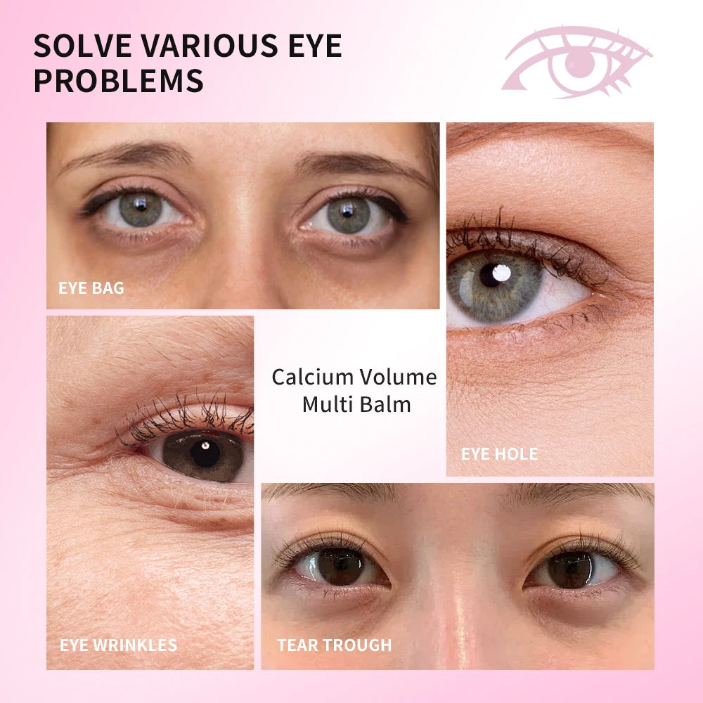 Calcium Volume Multi Balm Eye Wrinkle Cream Stick for Smoothing Skin and Reducing Dark Circles