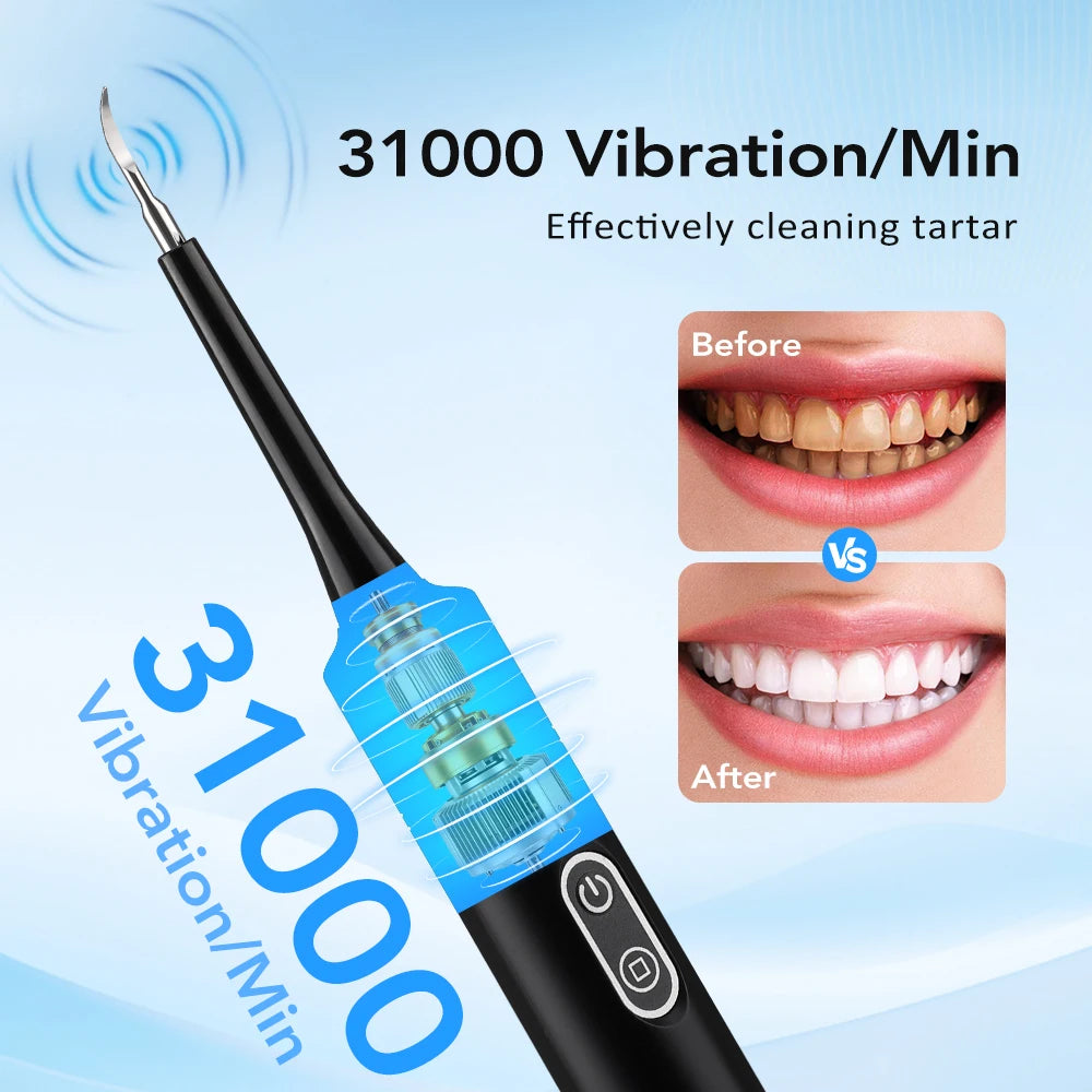 Electric Dental Scaler Tartar Remover for Teeth Whitening at Home for Adults and Personal Care