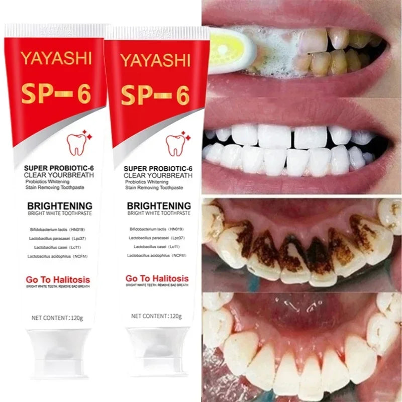 Probiotic Toothpaste Stain Removal and Teeth Whitening for Adults at Home
