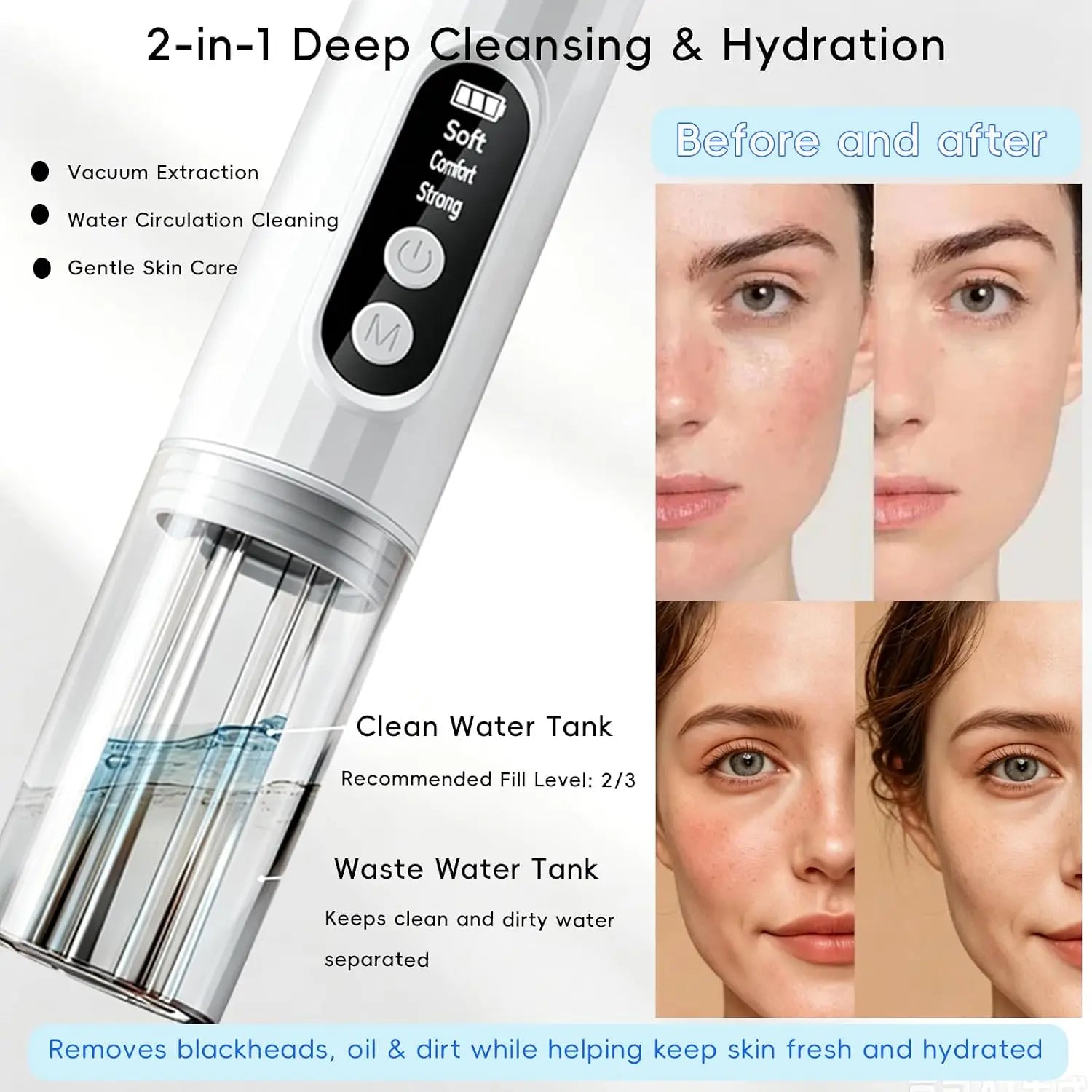 Pore Vacuum Blackhead Remover Deep Cleansing Tool for Radiant Skin and Face Daily Grooming - 2