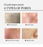 Salicylic Acid Pore Shrinking Cream Skin Repair Acne Treatment for Face and Smooth Texture
