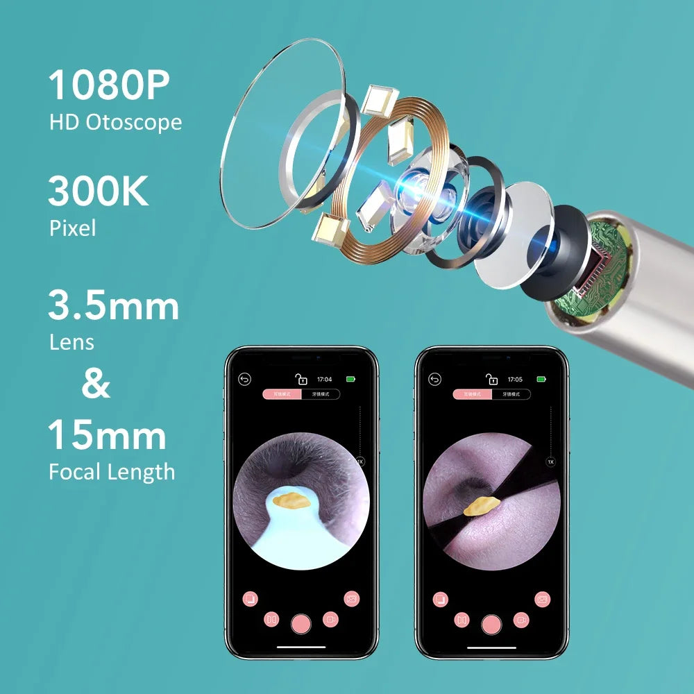 Smart Visual Ear Wax Cleaner with HD Camera and Tweezers for Adults and Kids at Home