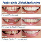 Veneer Snap on Teeth Kit Temporary Whitening Replacement for Men and Women Smile Enhancement