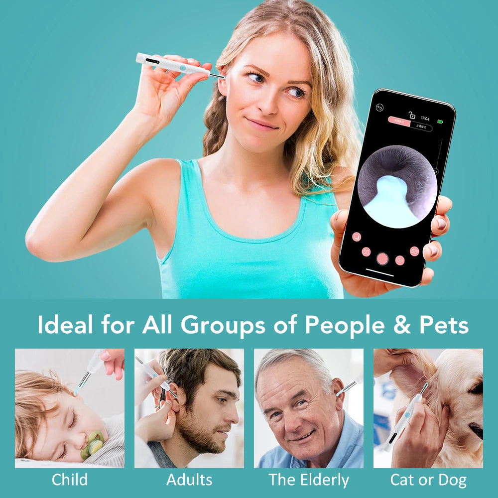 Smart Visual Ear Wax Cleaner with HD Camera and Tweezers for Adults and Kids at Home