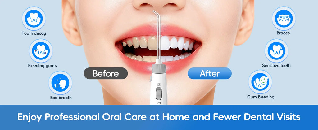 Electric Water Flosser Oral Irrigator with Multiple Tips for Adults at Home