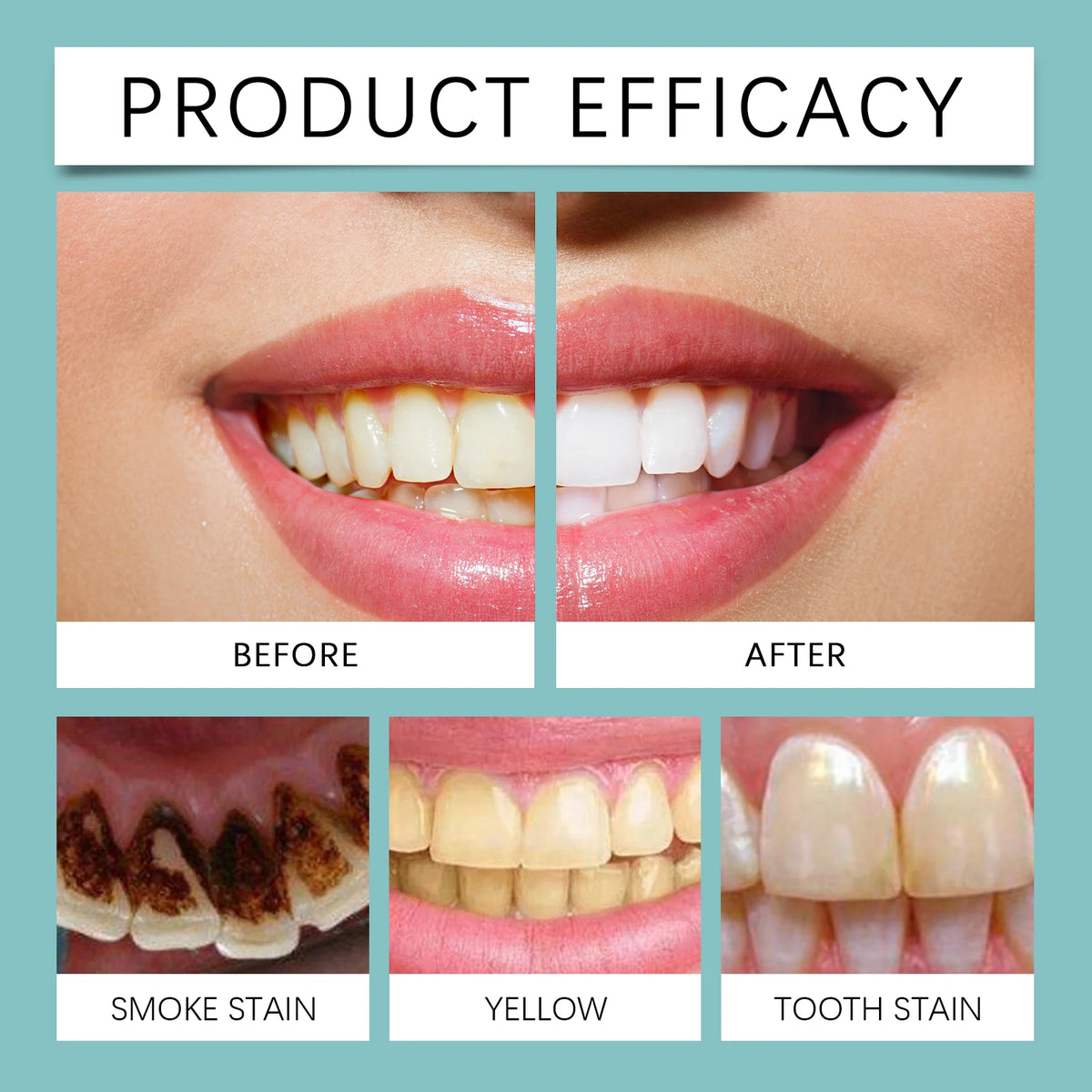 Teeth Whitening Paint Remove Dental Stains for Brighter Smile at Home