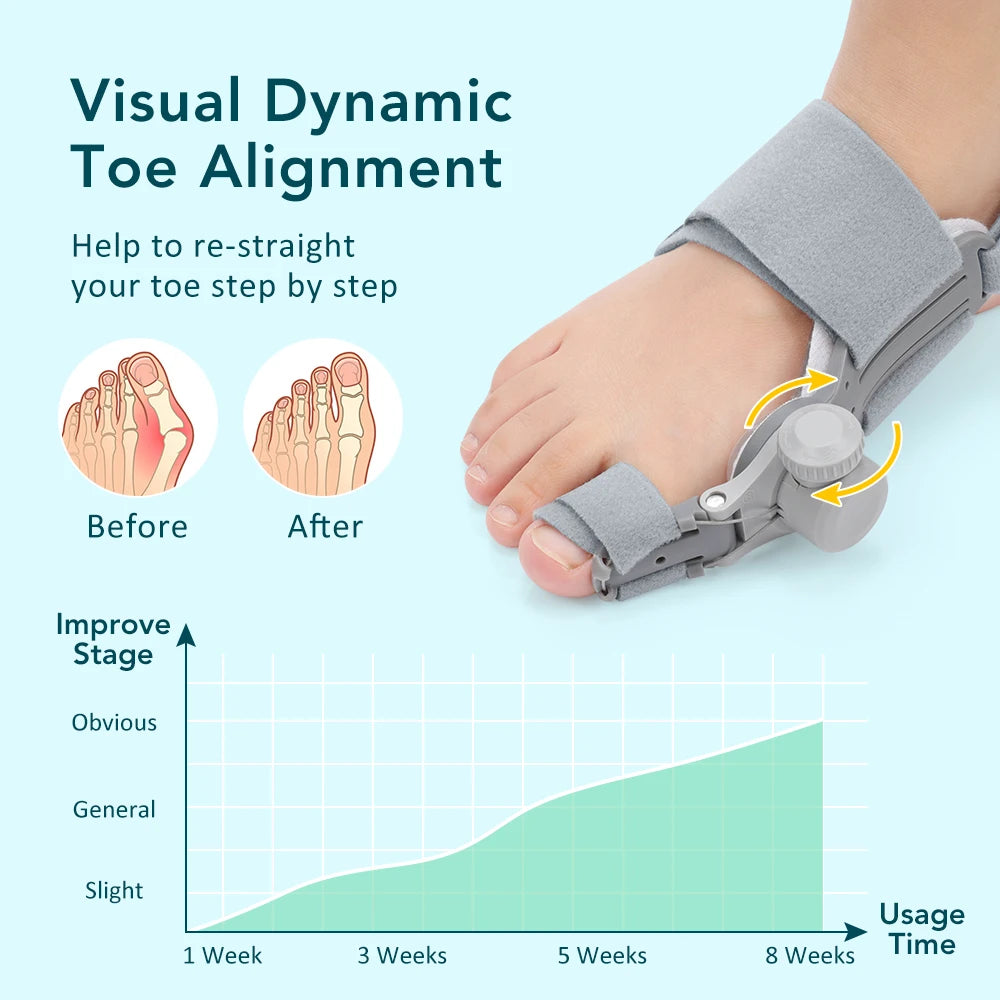Big Toe Valgus Corrector Adjustable Bunion Splint for Painless Foot Relief at Home