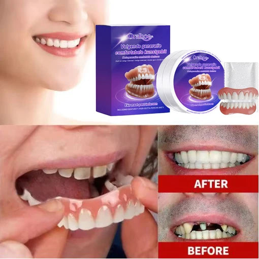Flexible Silicone Dentures Realistic False Teeth Comfort Fit for Natural Smile Replacement