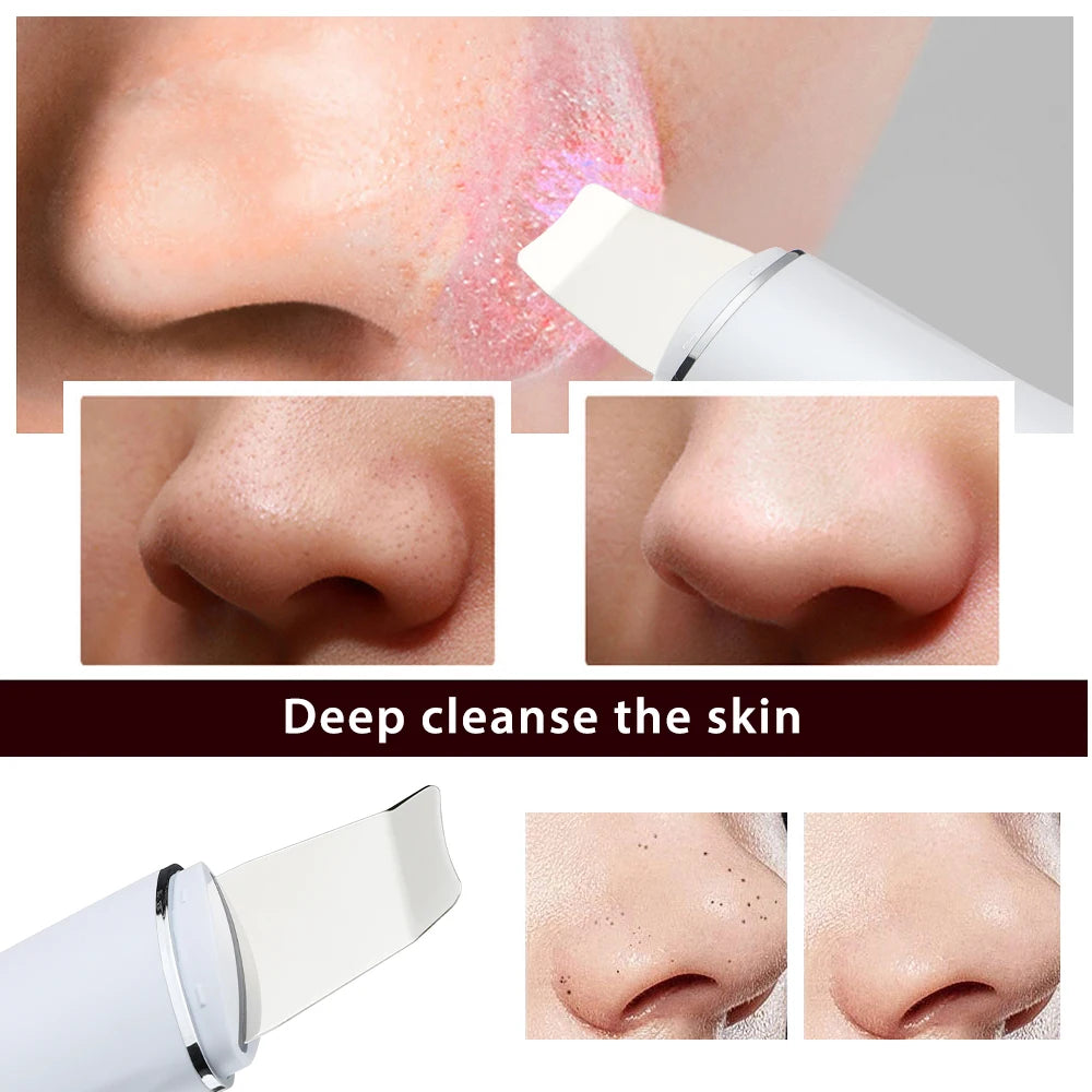 Ultrasonic Skin Scrubber Deep Face Pore Cleaner for Daily Facial Rejuvenation at Home - 6