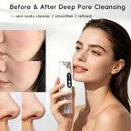 Pore Vacuum Blackhead Remover Deep Cleansing Tool for Radiant Skin and Face Daily Grooming