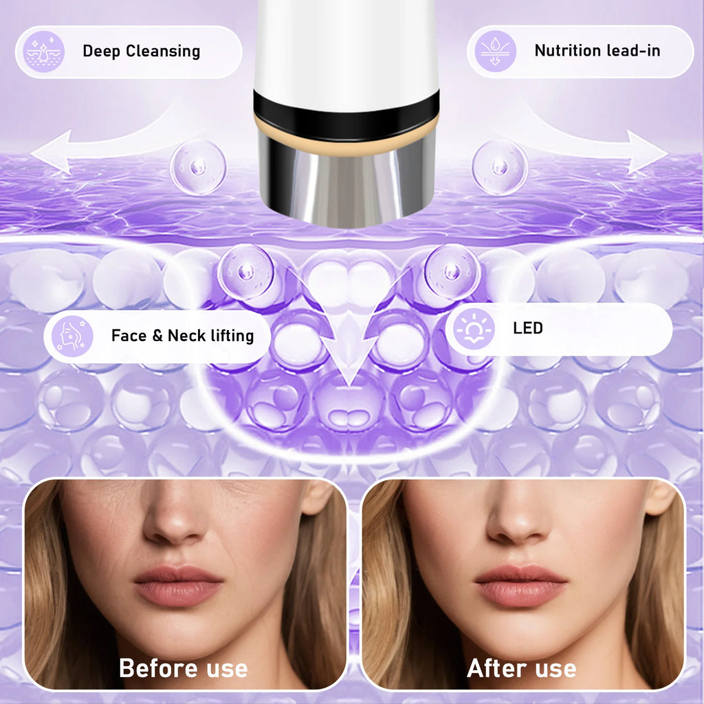 Microcurrent Facial Massager Skin Tightening Device for Women at Home Daily Care