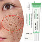 Salicylic Acid Pore Shrinking Cream Skin Repair Acne Treatment for Face and Smooth Texture