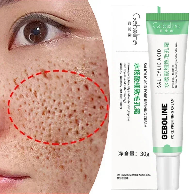 Salicylic Acid Pore Shrinking Cream Skin Repair Acne Treatment for Face and Smooth Texture