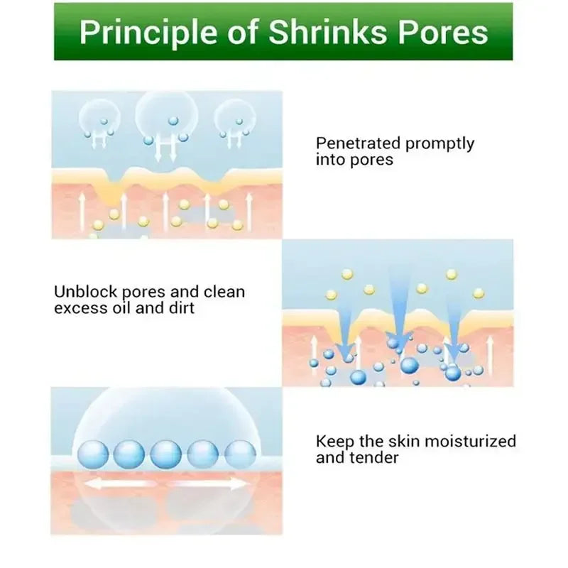 Salicylic Acid Pore Shrinking Cream Skin Repair Acne Treatment for Face and Smooth Texture