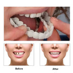 Veneer Snap on Teeth Kit Temporary Whitening Replacement for Men and Women Smile Enhancement