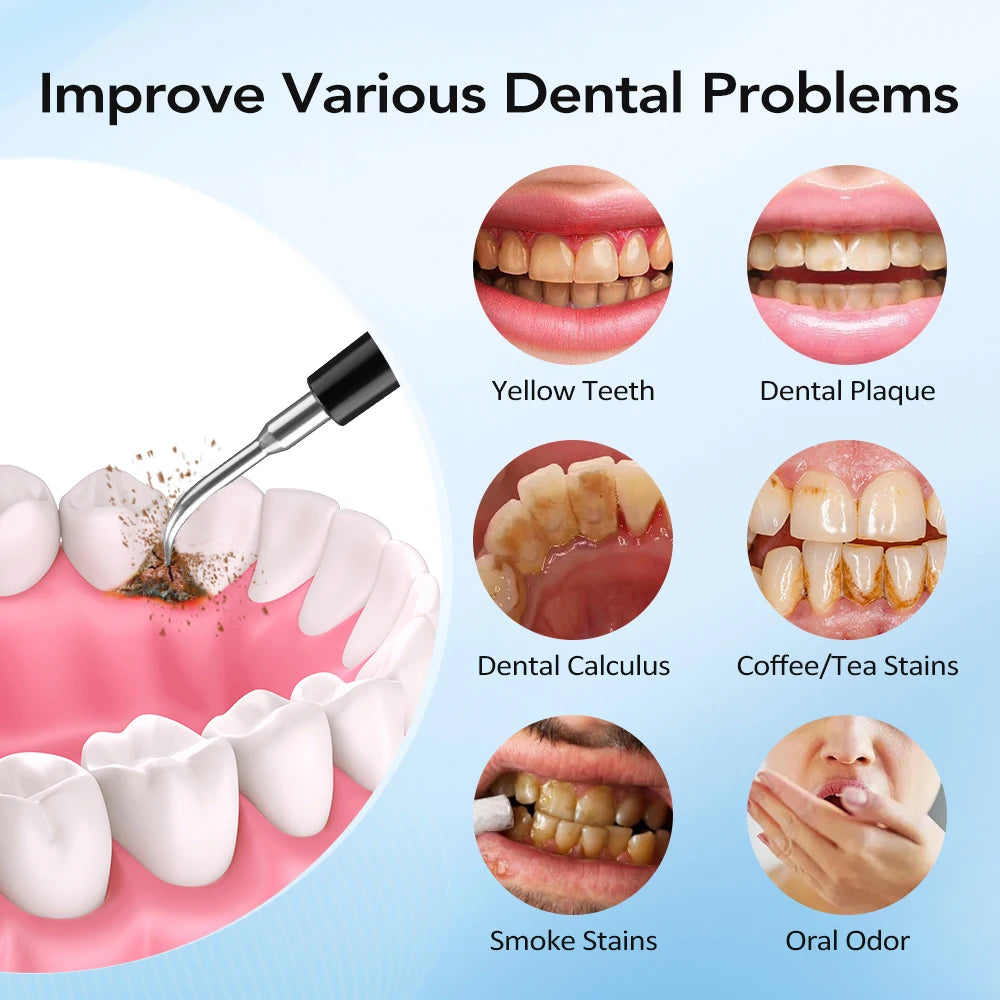 Electric Dental Scaler Tartar Remover for Teeth Whitening at Home for Adults and Personal Care