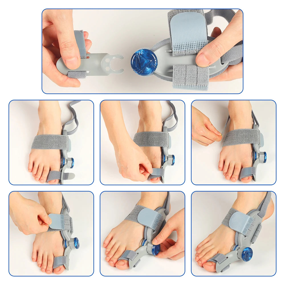 Big Toe Valgus Corrector Adjustable Bunion Splint for Painless Foot Relief at Home