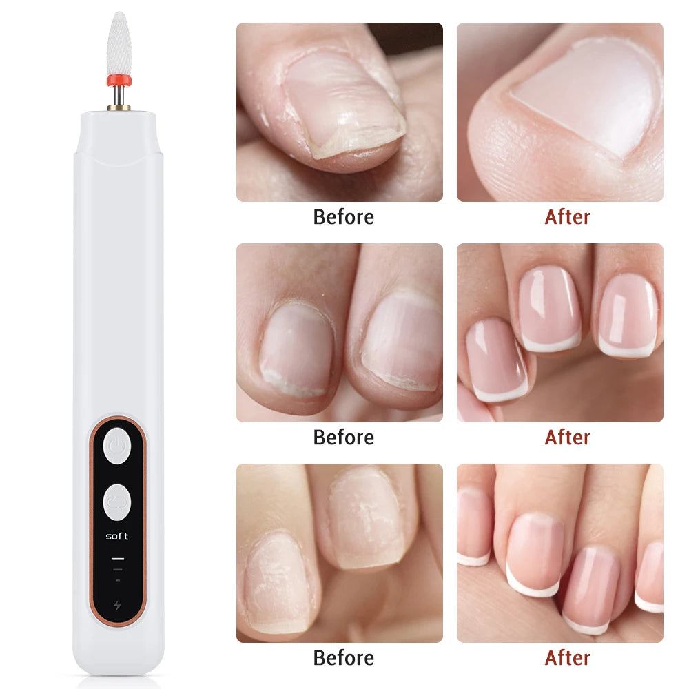 Electric Nail Drill Kit Cordless Manicure File for Home Salon Use on Fingernails Toenails