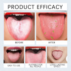 Tongue Cleaner Kit Remove Tongue Coating and Bad Breath for Daily Oral Hygiene Care