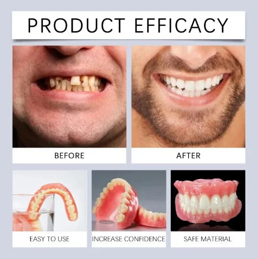 Full Mouth Silicone Dentures Realistic Fake Teeth for Better Smile Confidence at Home Daily
