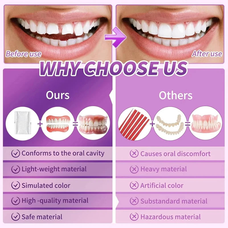 Full Set Silicone Dentures Natural False Teeth for Instant Smile Enhancement Daily
