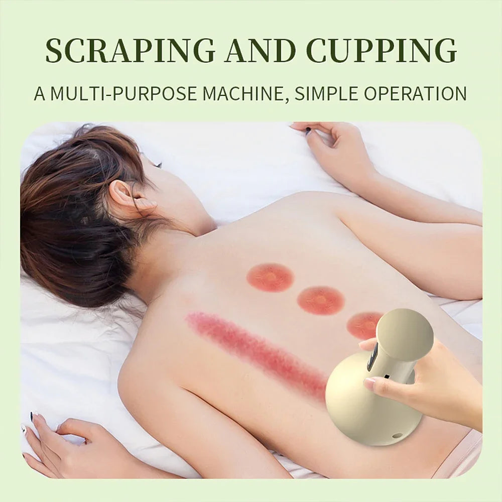 Electric Cupping Massager Scraping Tool Heated Meridian Device for Body Relaxation - 5