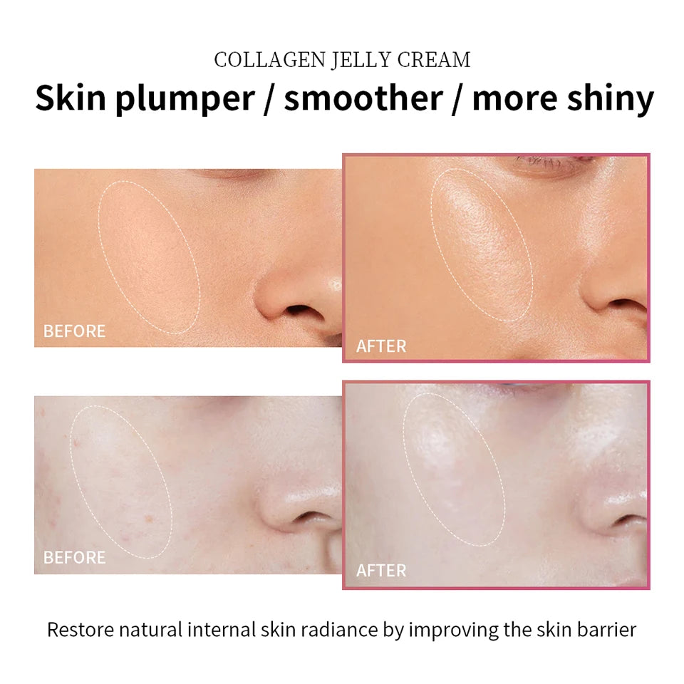Collagen Jelly Cream Deep Hydration Moisturizing Gel for Unisex Skin Tightening Face Routine - 11