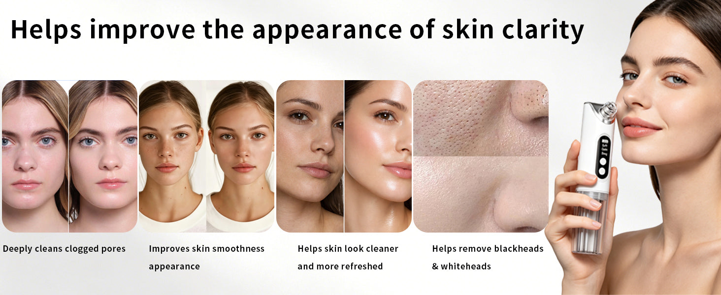 Pore Vacuum Blackhead Remover Deep Cleansing Tool for Radiant Skin and Face Daily Grooming - 10